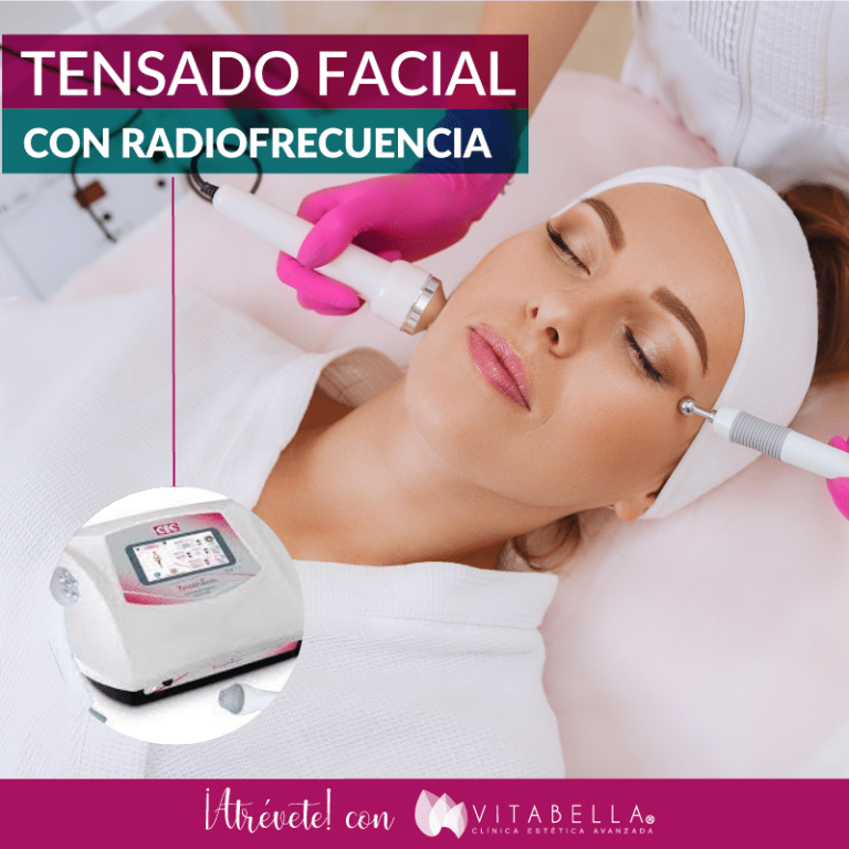 Tensado Facial con Radiofrecuencia Facial 10 sesiones Clínica Vitabella