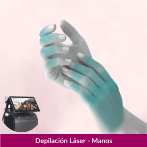 Depilación Láser Manos mujer con Soprano Titanium