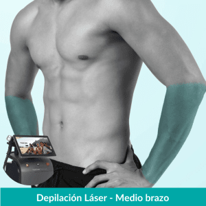 Depilación Láser Medio Brazo – Hombres