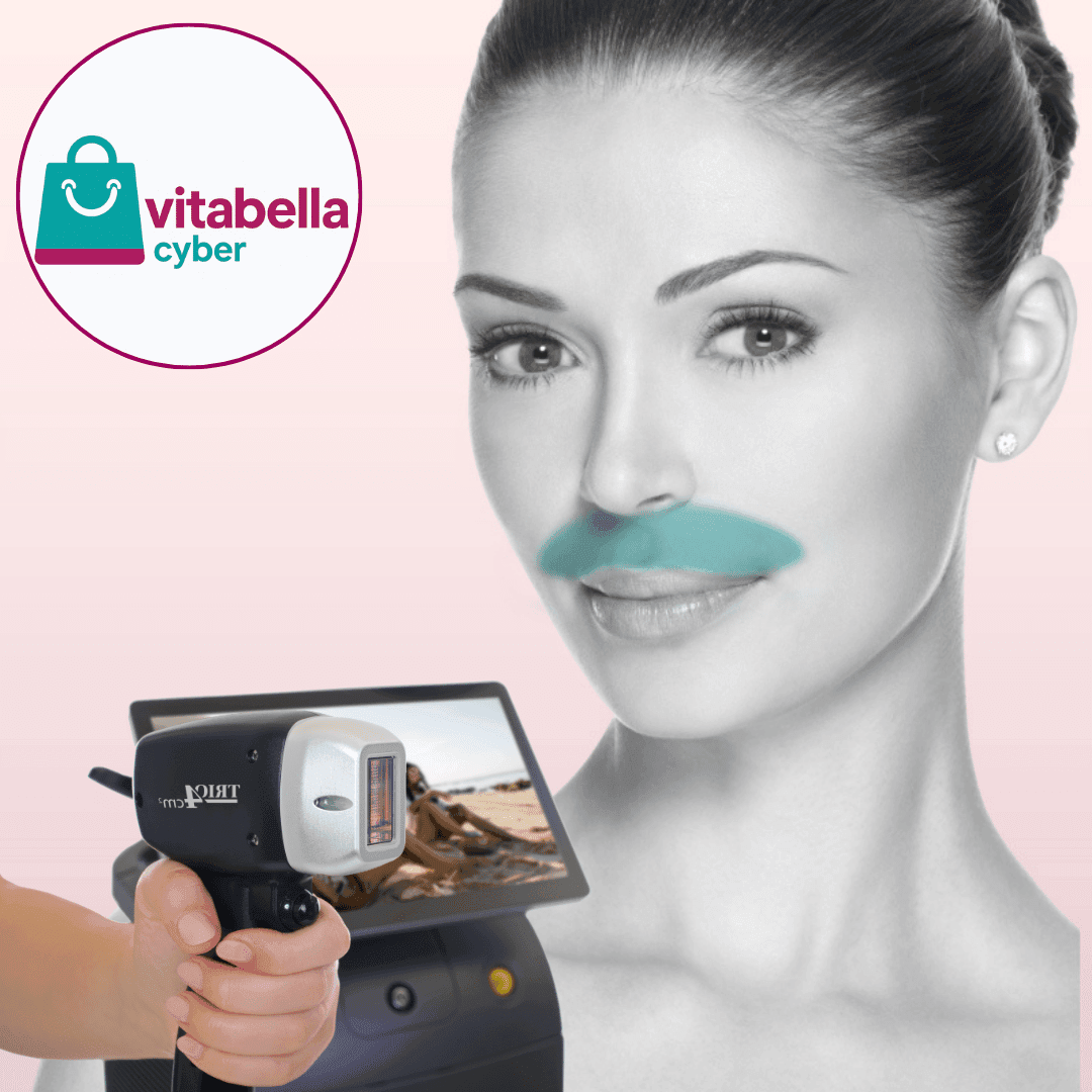 Cyber Vitabella: sesiones depilación láser bozo con Soprano Titanium