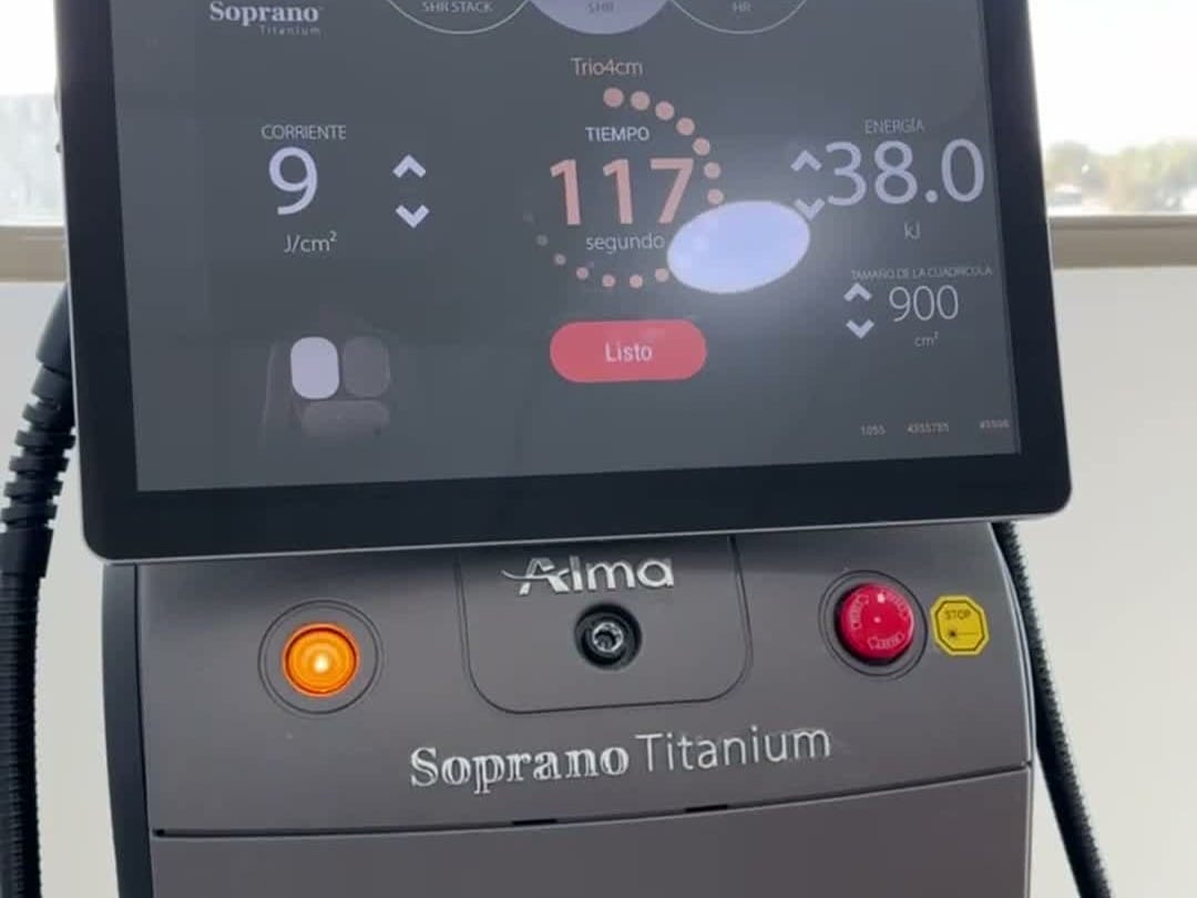 Equipo Soprano Titanium de Alma Lasers en Vitabella Calama